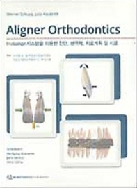  Aligner Orthodontics