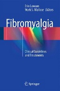  Fibromyalgia