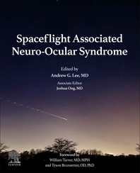  Spaceflight Associated Neuro-Ocular Syndrome