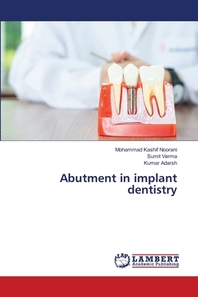  Abutment in implant dentistry