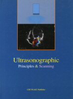  ULTRASONOGRAPHIC