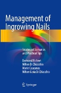  Management of Ingrowing Nails