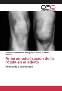  Anteromedializacion de La Rotula En El Adulto