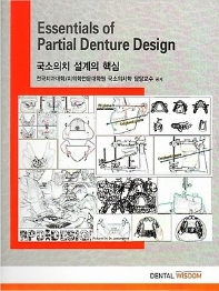  국소의치 설계의 핵심(Essentials of Partial Denture Design)