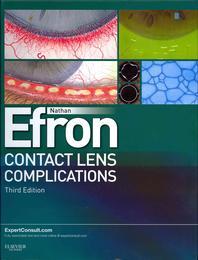  Contact Lens Complications