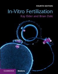  In-Vitro Fertilization