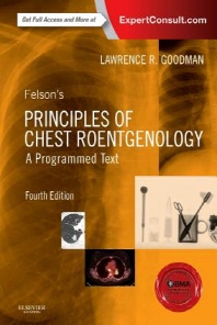  Felson's Principles of Chest Roentgenology, a Programmed Text