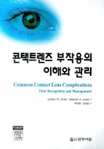  콘택트렌즈 부작용의 이해와 관리