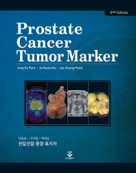 전립선암 종양 표지자(Prostate Cancer Tumor Marker)