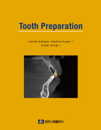  Tooth Preparation