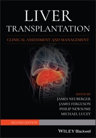  Liver Transplantation