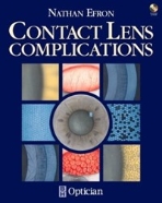 Contact Lens Complications (CD-ROM Included) (ISBN : 9780750605823)
